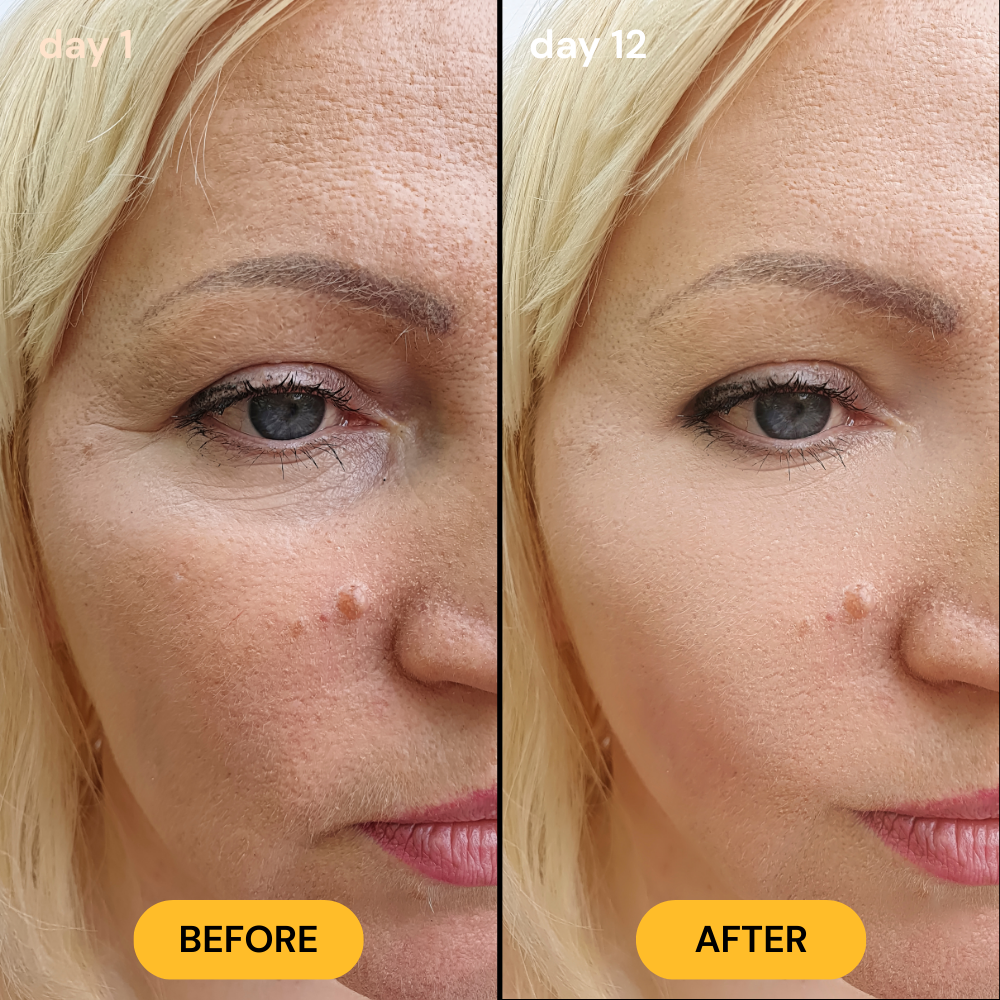 Lomelia Rice Ampoule Peel Shot Kit